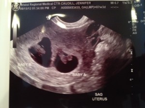 8.15.12 first ultrasound